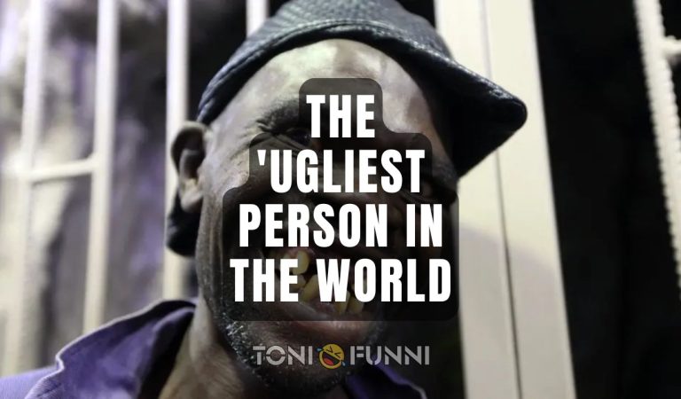 the most ugliest person in the world